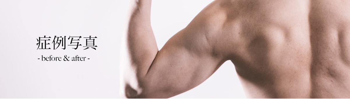 メンズ脱毛サロン　〜M.M.M〜　メンズによるメンズのためのメンズだけのサロン　アバウト　イメージ画像